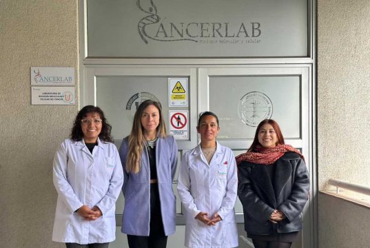 Laboratorio “CancerLab” de la UCN investiga potencial de ácidos grasos provenientes de desechos marinos para elaborar nutracéutico contra el cáncer
